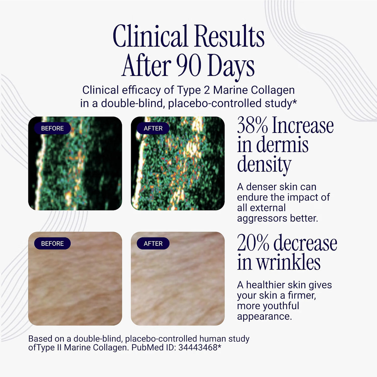 Liposomal Collagen Peptides