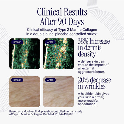 Liposomal Collagen Peptides